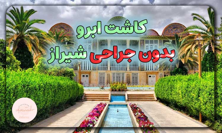 کاشت ابرو بدون جراحی شیراز