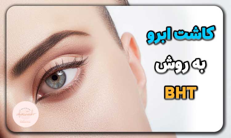 کاشت ابرو به روش bht