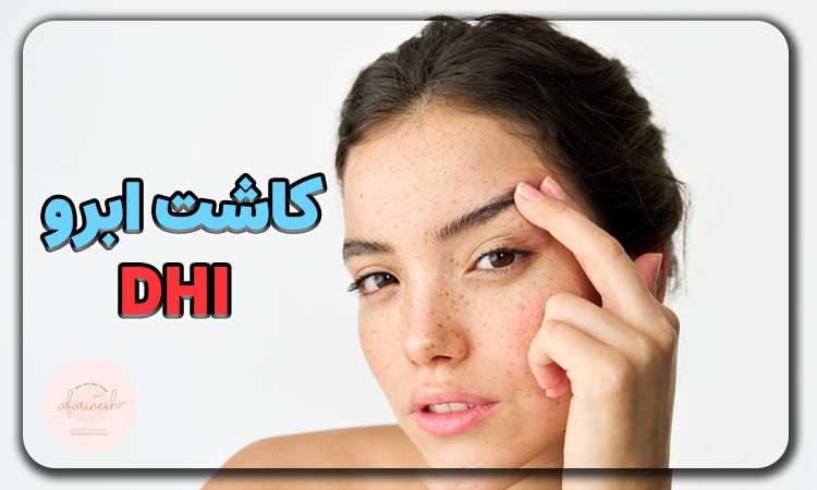 کاشت ابرو به روش dhi