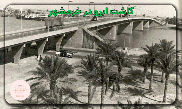 کاشت ابرو در خرمشهر