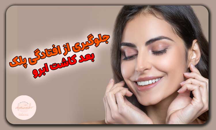 جلوگیری از افتادگی پلک بعد کاشت ابرو