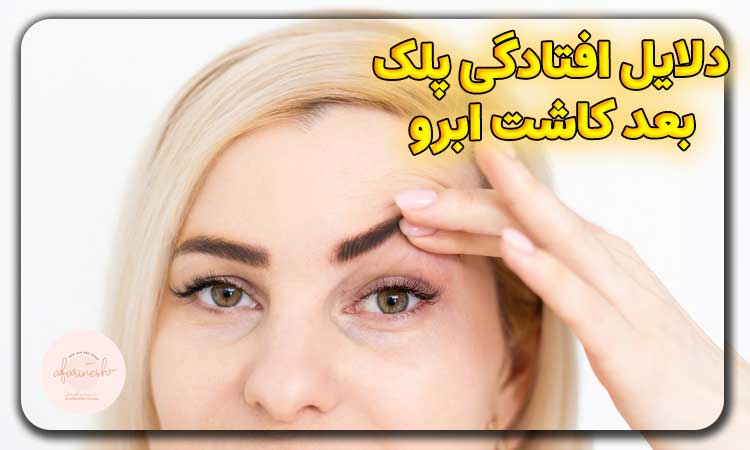 دلایل افتادگی پلک بعد از کاشت ابرو