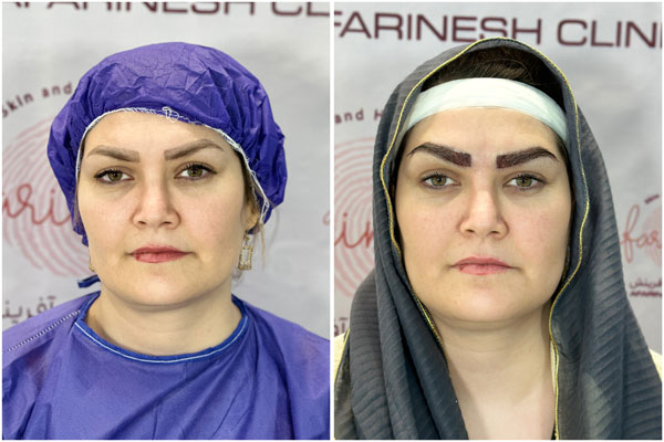 کلینیک پوست و مو آریان