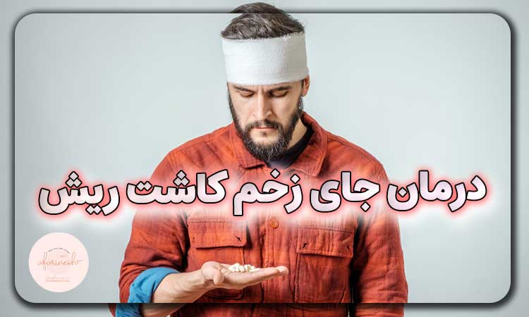 درمان جای زخم کاشت ریش