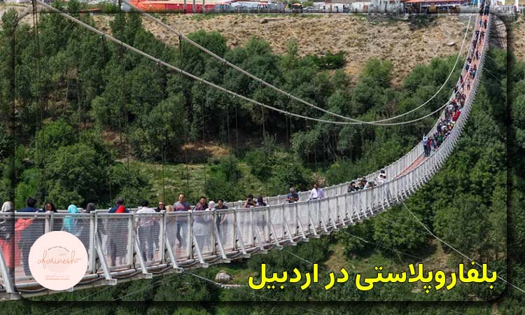 بلفاروپلاستی در اردبیل