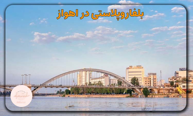 بلفاروپلاستی در اهواز