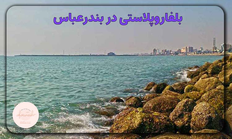 بلفاروپلاستی در بندرعباس