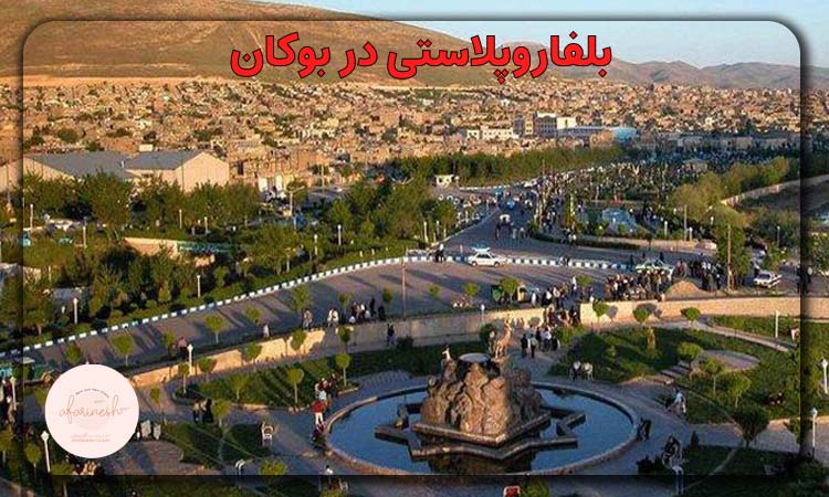 بلفاروپلاستی در بوکان