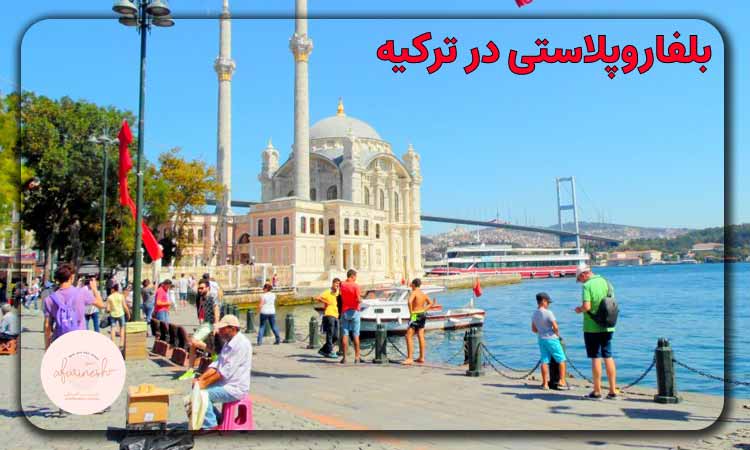 بلفاروپلاستی در ترکیه
