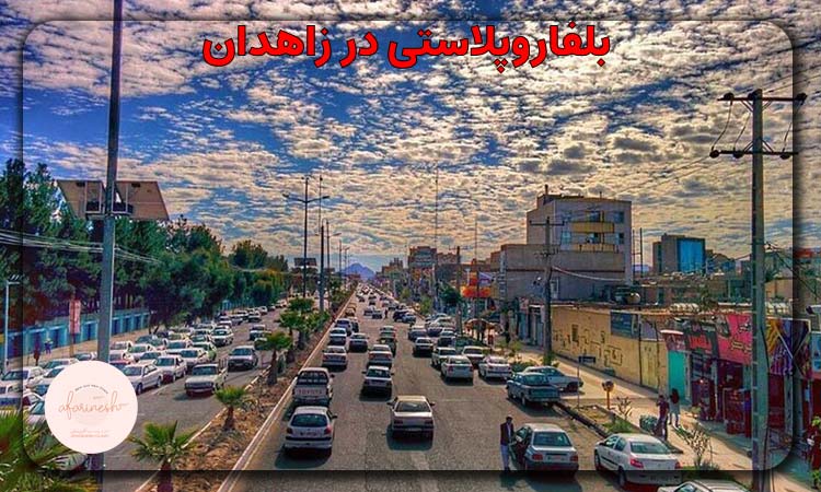 بلفاروپلاستی در زاهدان