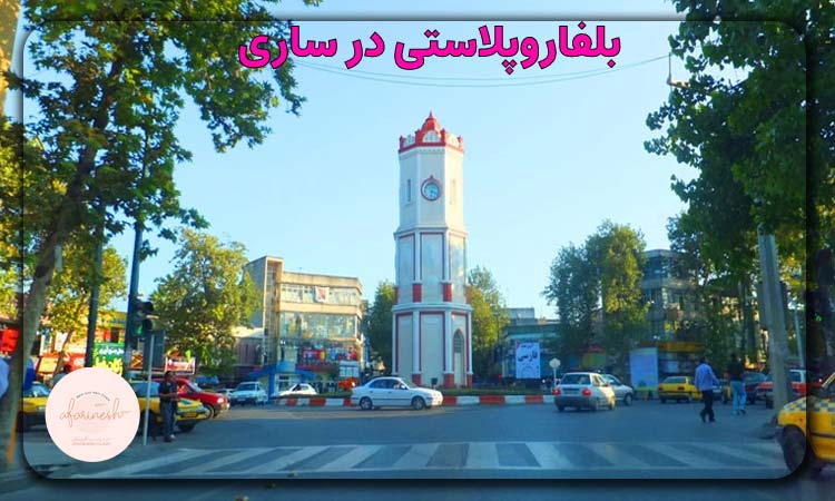 بلفاروپلاستی در ساری