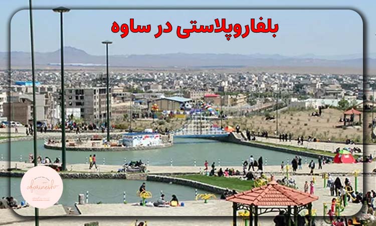بلفاروپلاستی در ساوه
