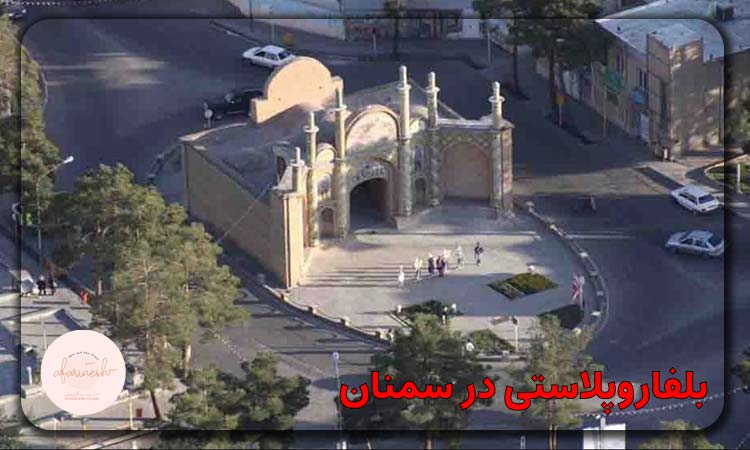 بلفاروپلاستی در سمنان