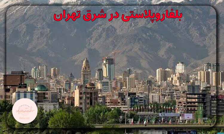 بلفاروپلاستی در شرق تهران