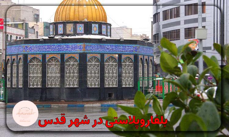 بلفاروپلاستی در شهر قدس