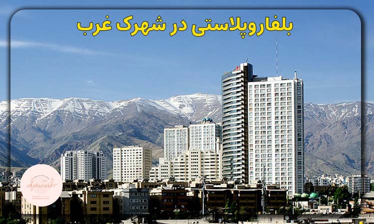 بلفاروپلاستی در شهرک غرب