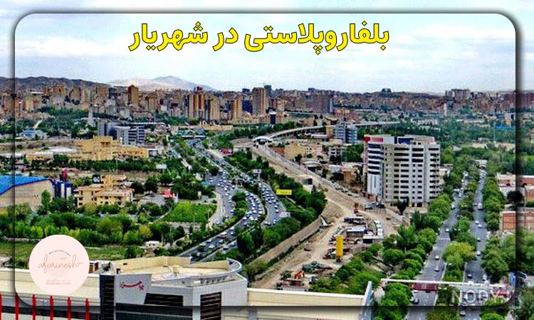 بلفاروپلاستی در شهریار