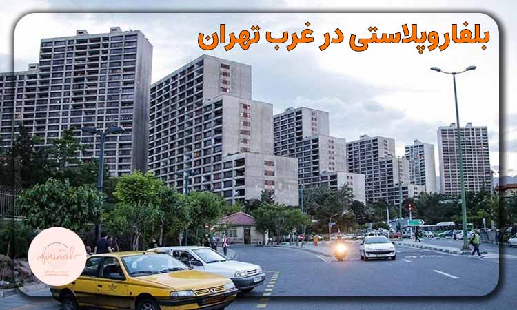 بلفاروپلاستی در غرب تهران