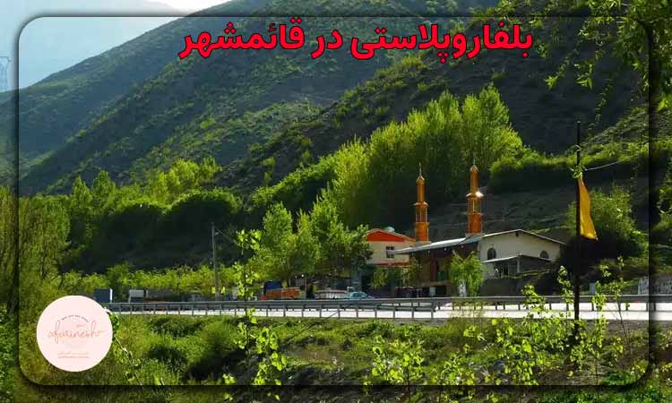 بلفاروپلاستی در قائمشهر