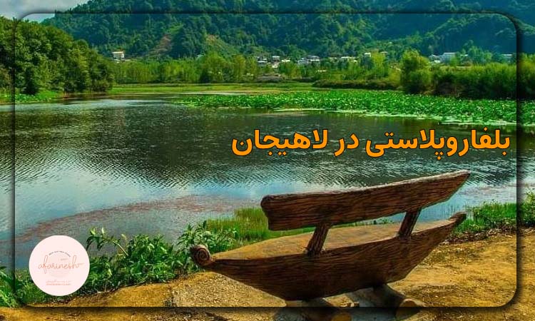 بلفاروپلاستی در لاهیجان