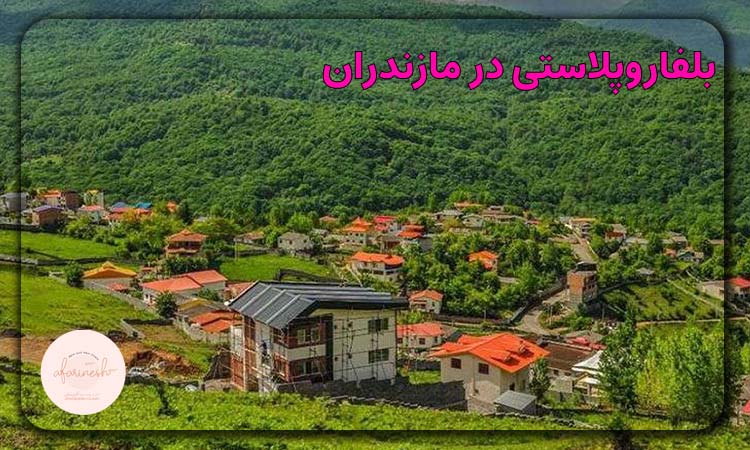 بلفاروپلاستی در مازندران