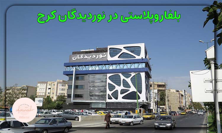 بلفاروپلاستی در نوردیدگان کرج