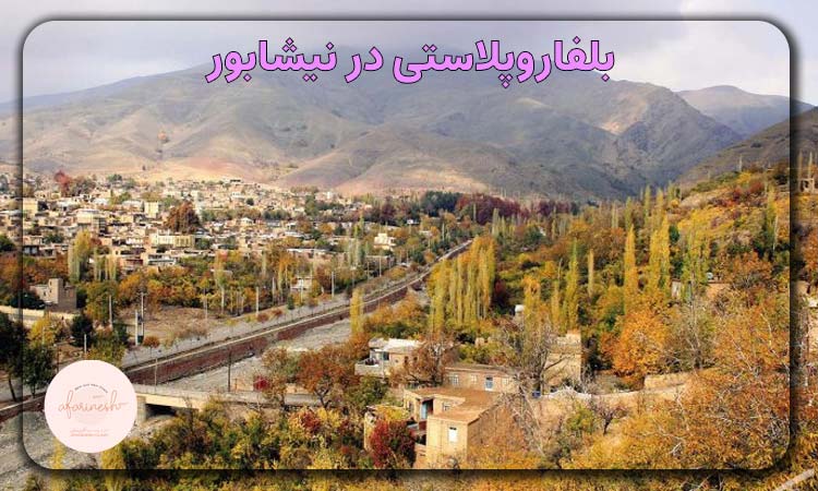 بلفاروپلاستی در نیشابور