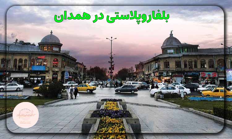 بلفاروپلاستی در همدان