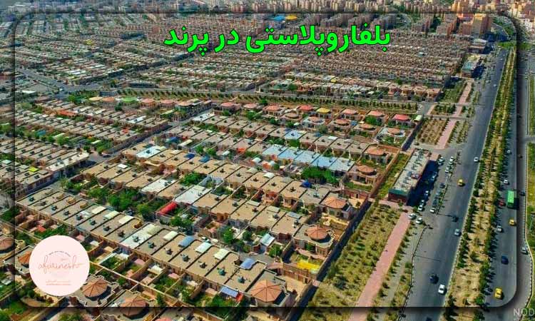 بلفاروپلاستی در پرند