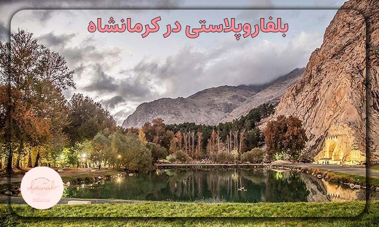 بلفاروپلاستی در کرمانشاه