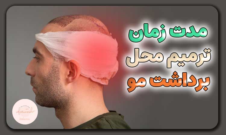 مدت زمان ترمیم محل برداشت مو