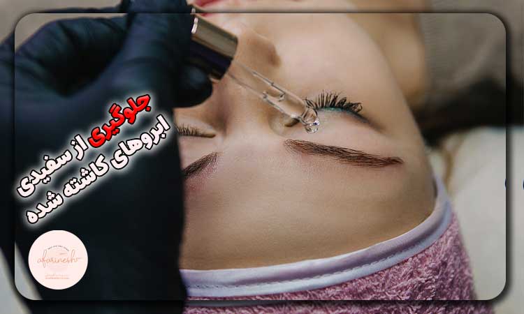 جلوگیری از سفید شدن ابرو‌های کاشته شده