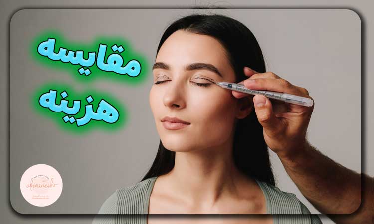 مقایسه قیمت بلفاروپلاستی با پتوز