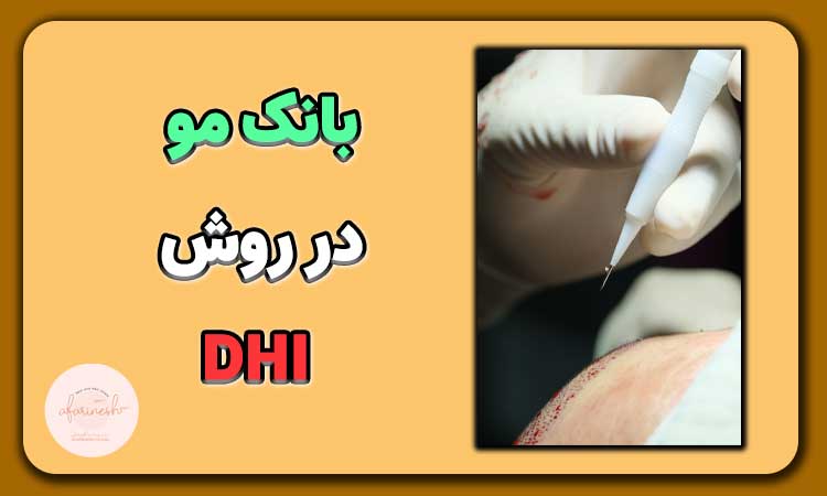 بانک مو در روش dhi