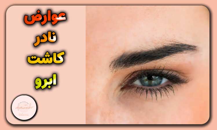 عوارض نادر کاشت ابرو