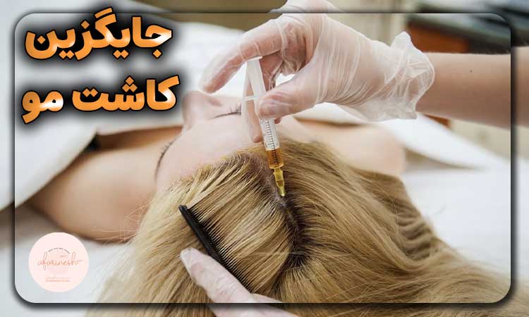 روش های رویش مجدد مو بدون کاشت