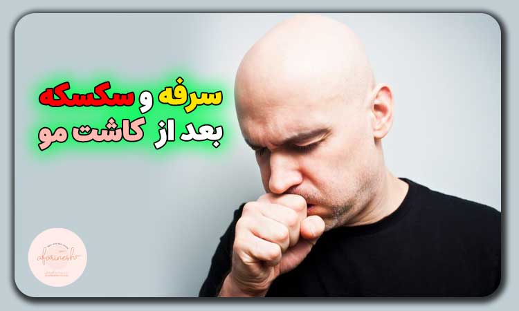 سرفه و سکسکه بعد از کاشت مو