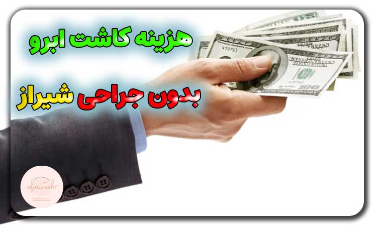 هزینه کاشت ابرو بدون جراحی شیراز