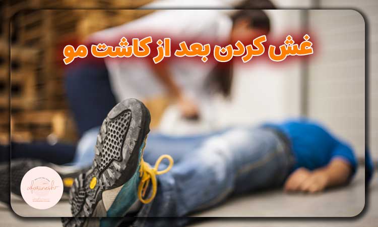 غش کردن بعد از کاشت مو