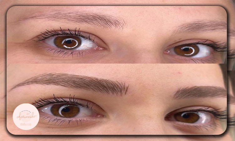 فیبروز ابرو (Phibrows)
