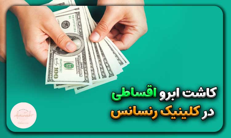 کاشت ابرو اقساطی در کلینیک رنسانس