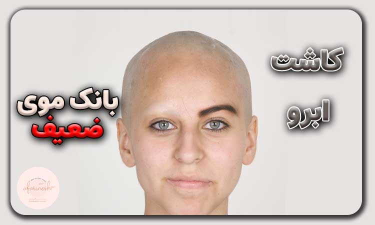 کاشت ابرو با بانک موی ضعیف