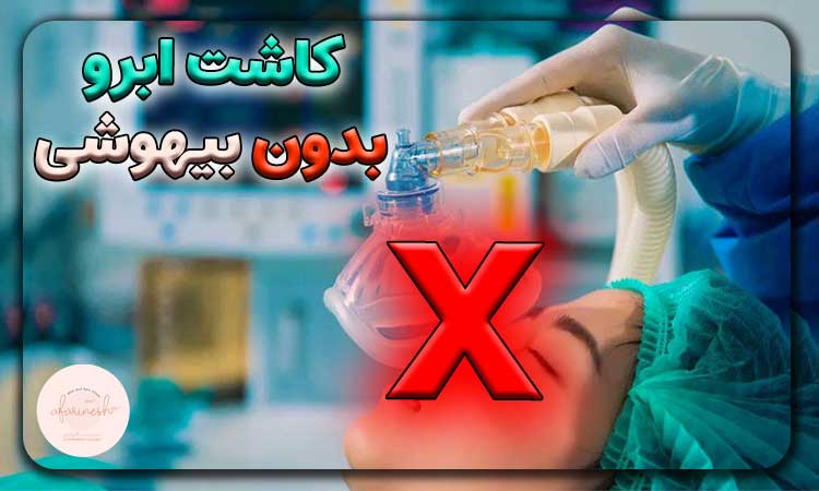 کاشت ابرو بدون بیهوشی