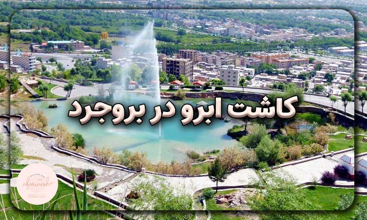 کاشت ابرو در بروجرد