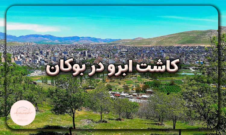 کاشت ابرو در بوکان