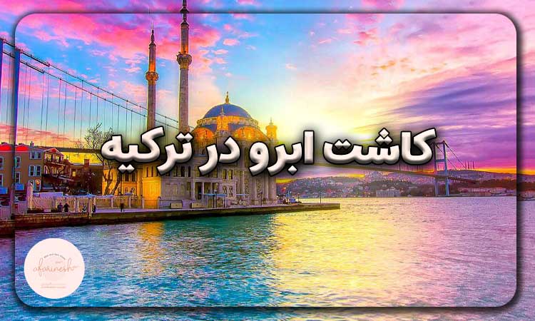 کاشت ابرو در ترکیه