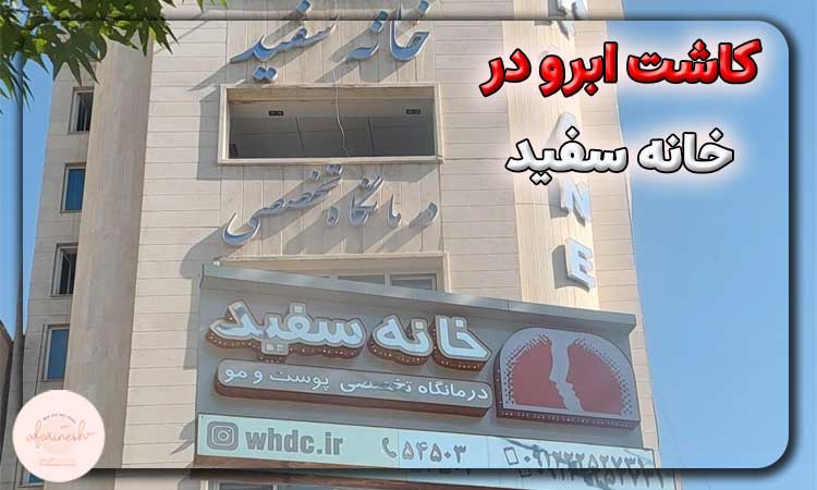 کاشت ابرو در خانه سفید