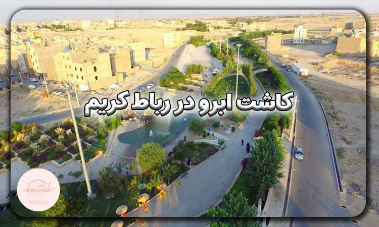کاشت ابرو در رباط کریم