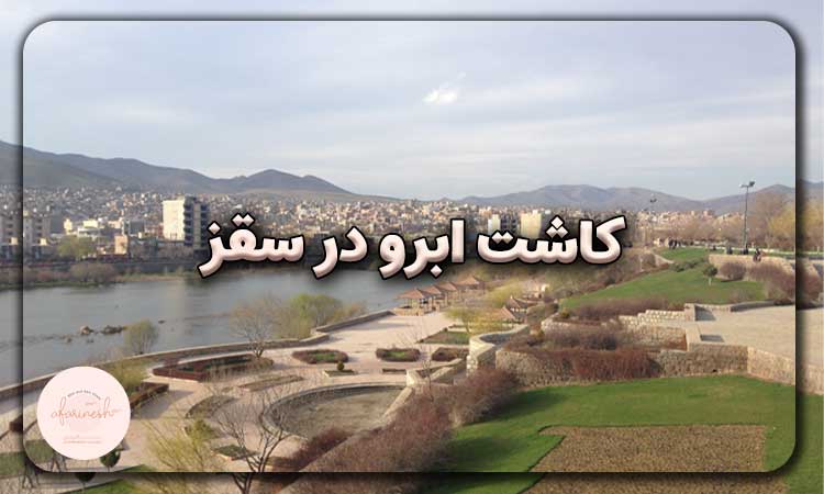 کاشت ابرو در سقز