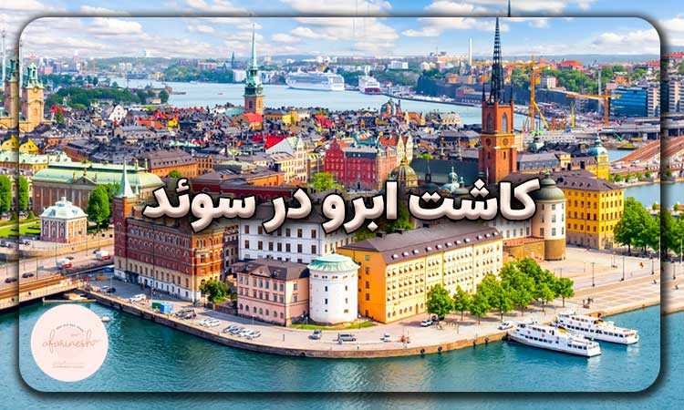 کاشت ابرو در سوئد